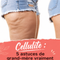 Femme appliquant un remède naturel pour lutter contre la cellulite sur ses cuisses.