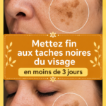 Femme souriante montrant un visage éclatant sans taches