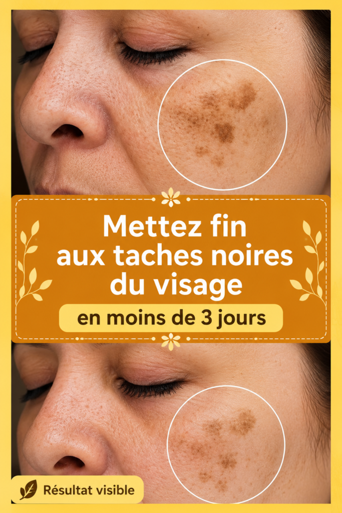 Femme souriante montrant un visage éclatant sans taches