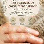 Image d'une femme utilisant des remèdes naturels pour soulager la dyshidrose