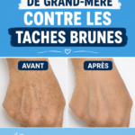 Bouteille de mélange d'huiles essentielles pour traiter les taches brunes sur la peau.