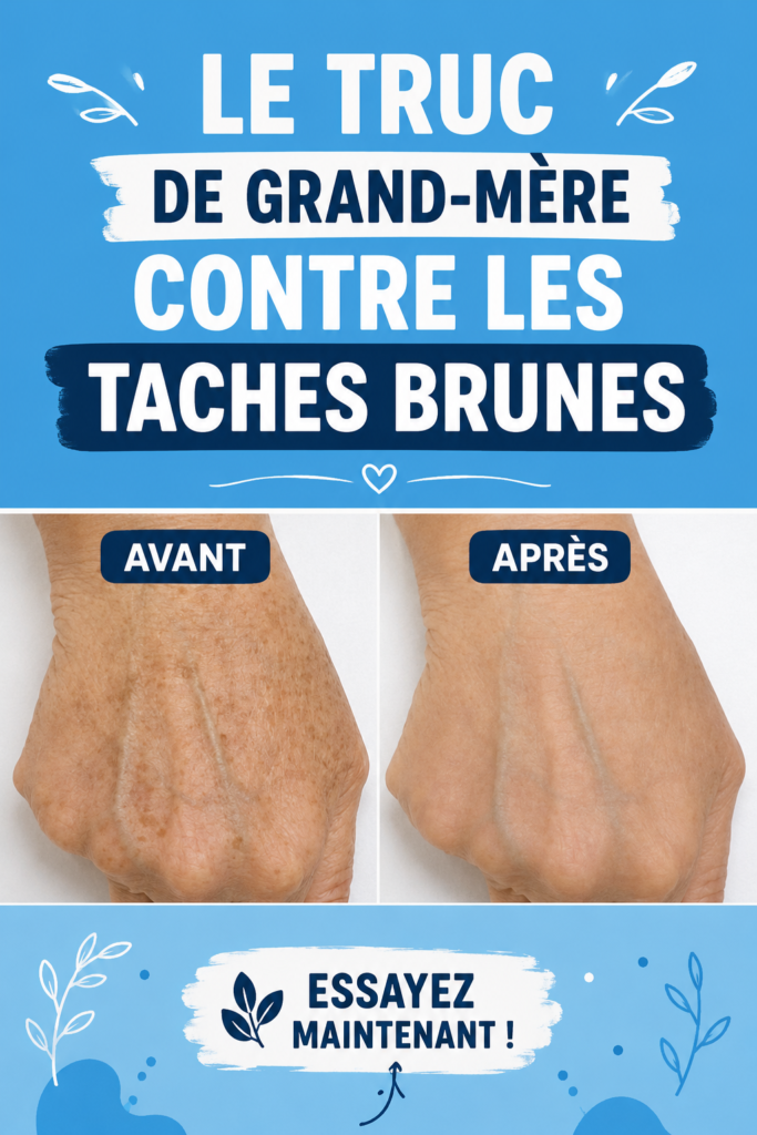 Bouteille de mélange d'huiles essentielles pour traiter les taches brunes sur la peau.