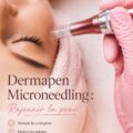 Femme recevant un traitement dermapen pour rajeunir sa peau.