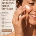 Femme souriante avec une peau éclatante, sans taches brunes